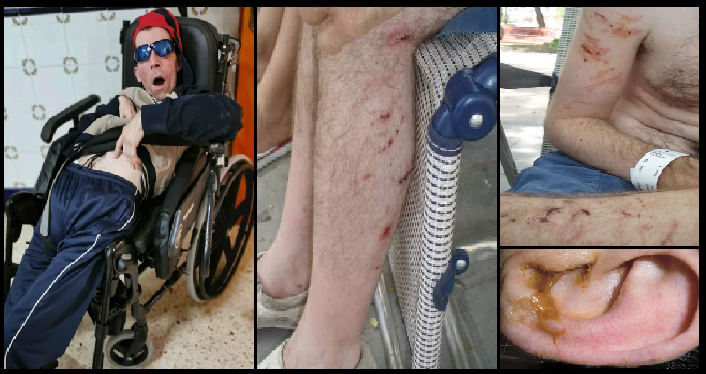 Heridas de Juanjo, mal cuidado